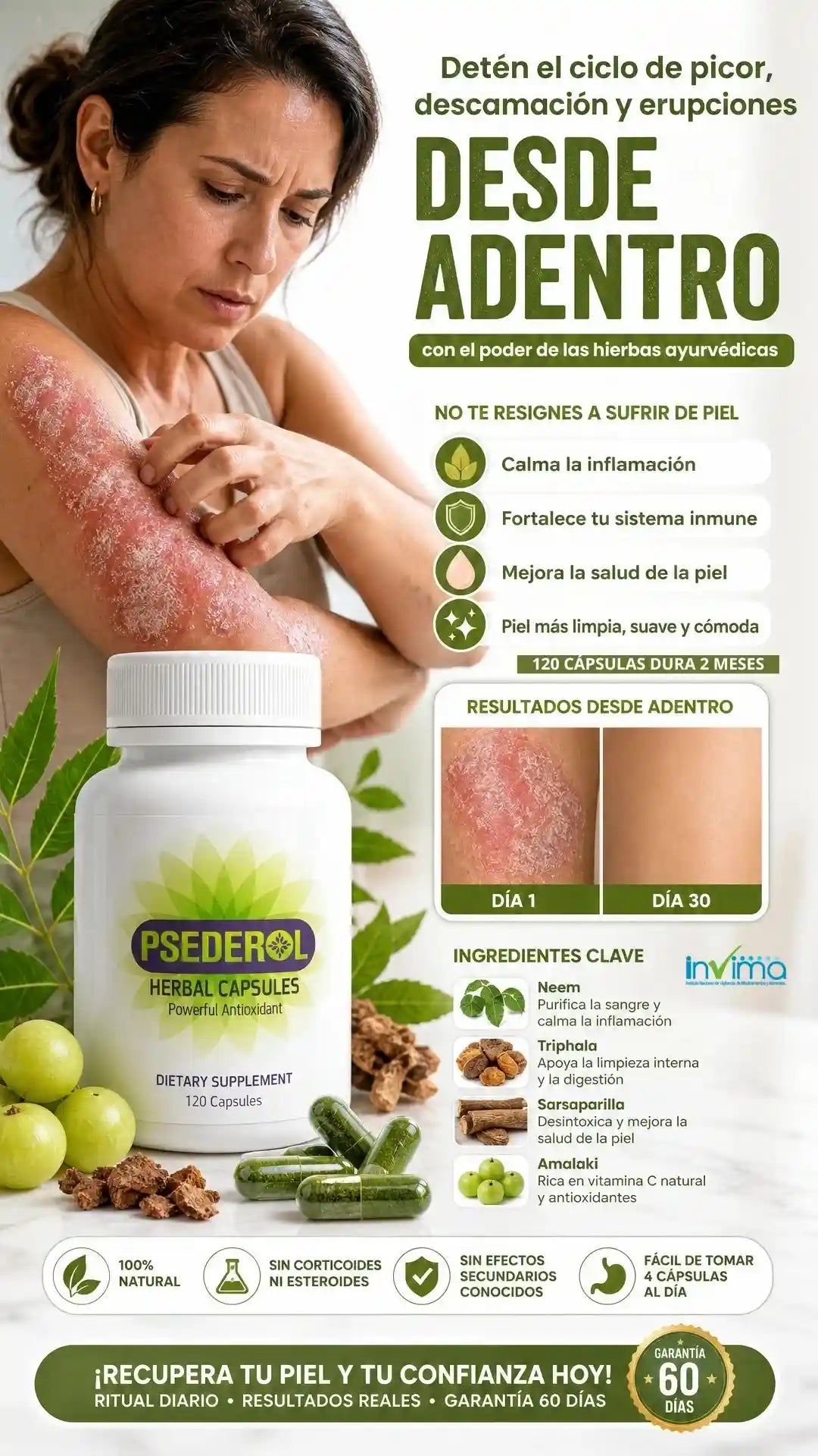 Psederol Detén la Psoriasis Desde Adentro