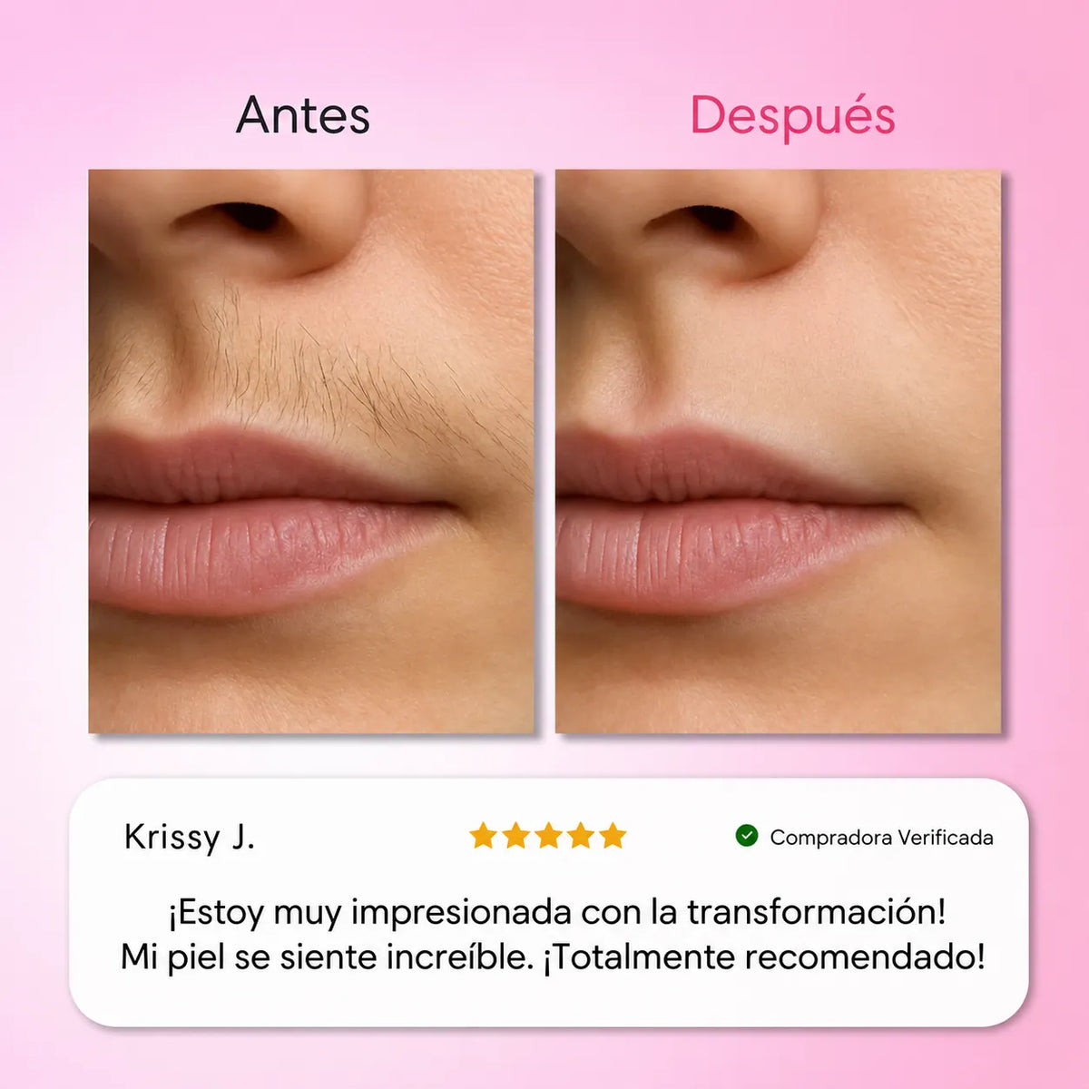 Kit Trilogía de Depilación