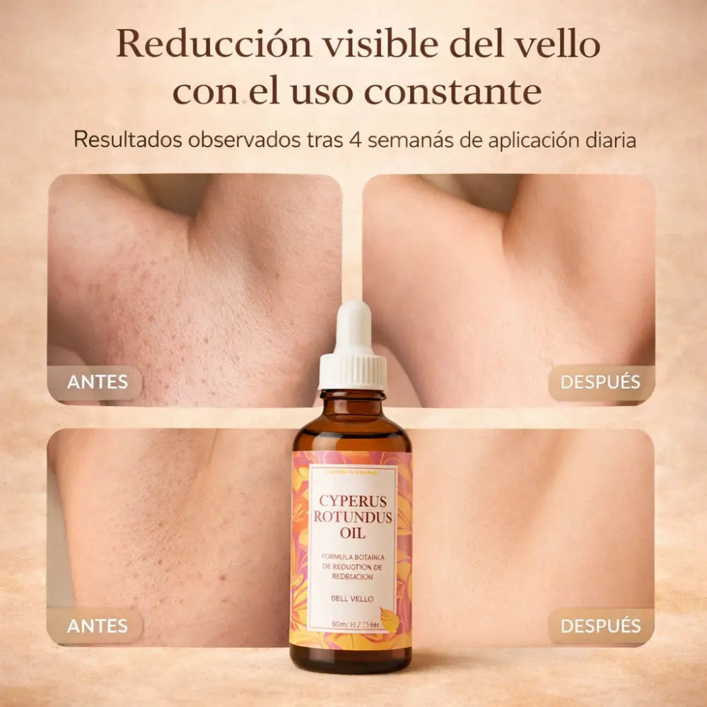 Aceite de Cyperus Rotundus para Reducir el Vello Naturalmente