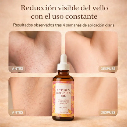 Aceite de Cyperus Rotundus para Reducir el Vello Naturalmente