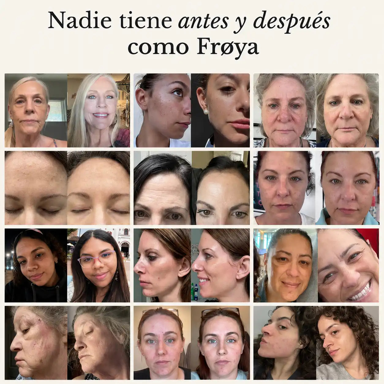 Bálsamo Anti-Edad para Piel Madura 40+