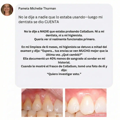 El "Restaurador de Encías" Más Potente Del Mercado – Collagum™