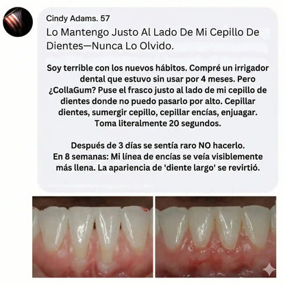 El "Restaurador de Encías" Más Potente Del Mercado – Collagum™