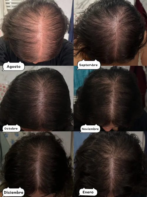 Hair Bond