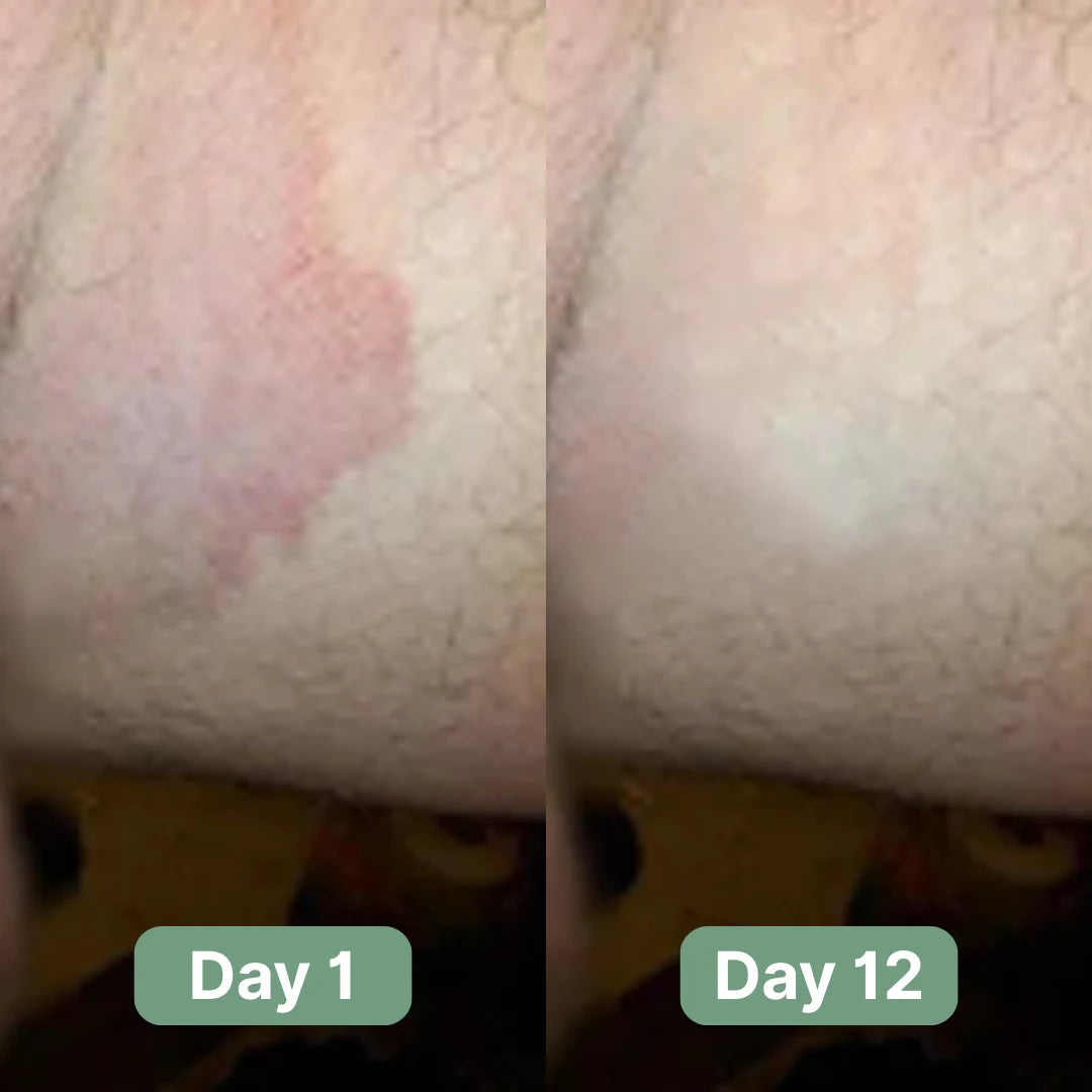 Veloma Antifungal Soap®