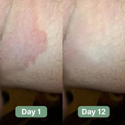 Veloma Antifungal Soap®