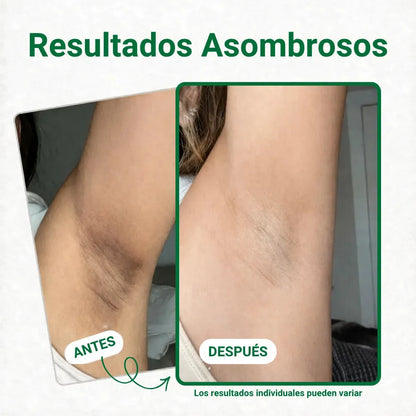 Pads despigmentantes y aclarantes